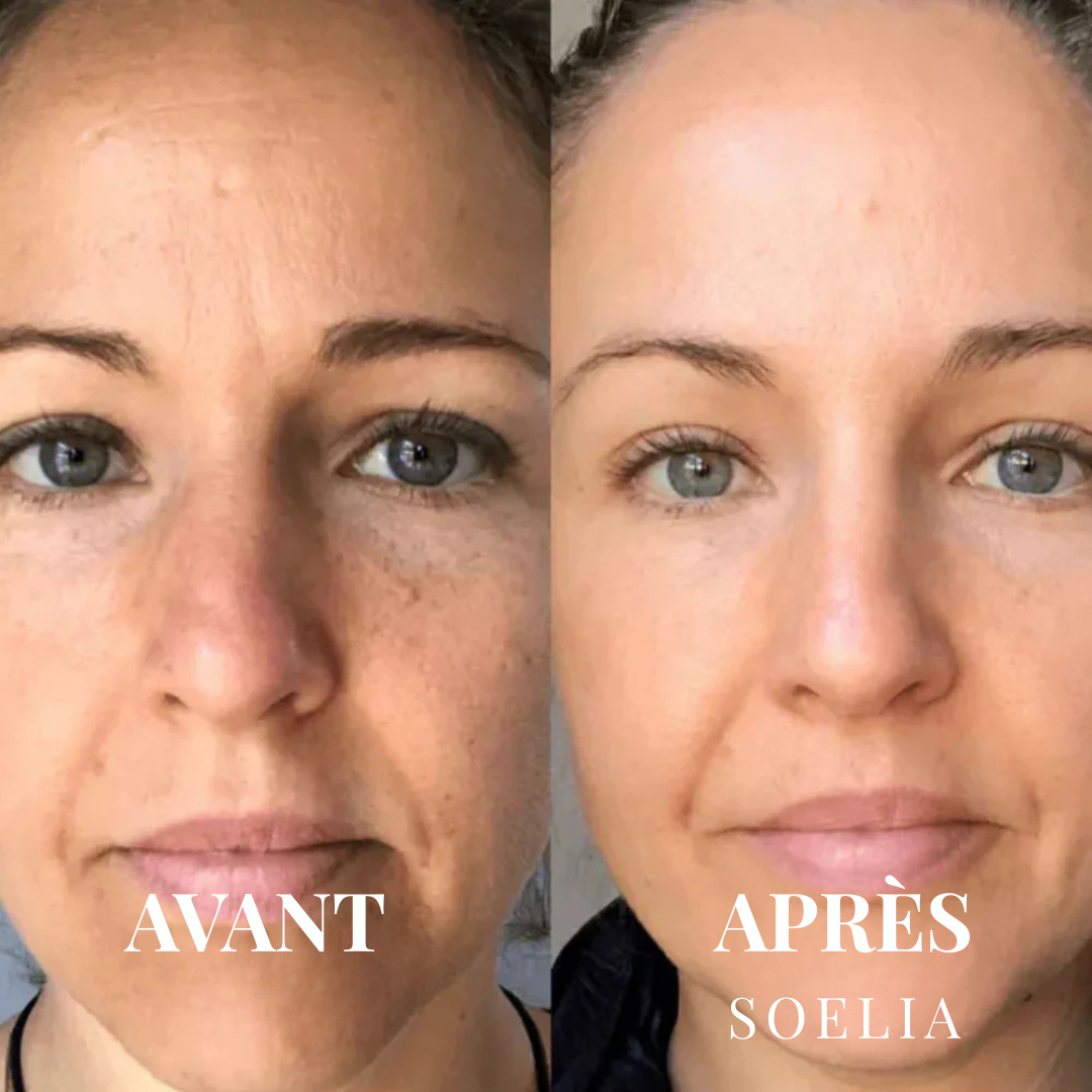 Soeliabeauty™ - Éclat Flash | Le Sérum Coréen Exfoliant au Riz